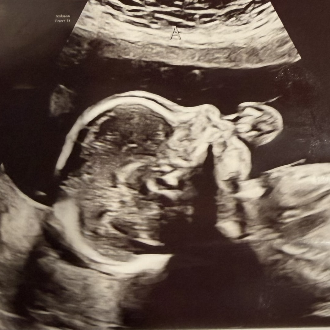 Photo shared by Stephanie for their Babylist baby registry.