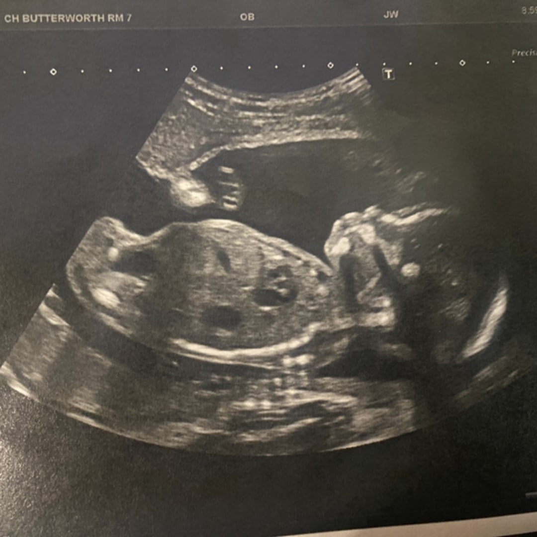 Photo shared by Kierstyn for their Babylist baby registry.