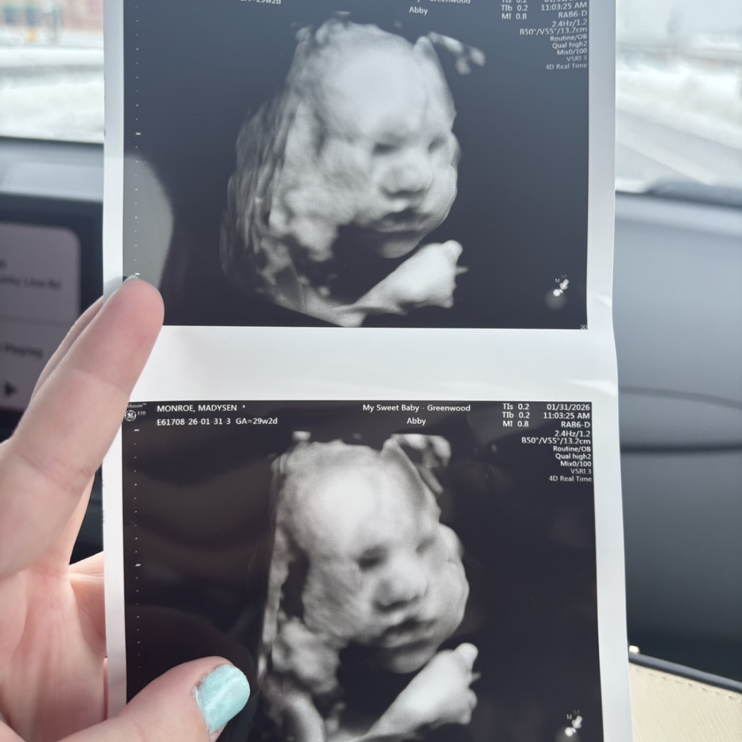 Photo shared by Madysen for their Babylist baby registry.