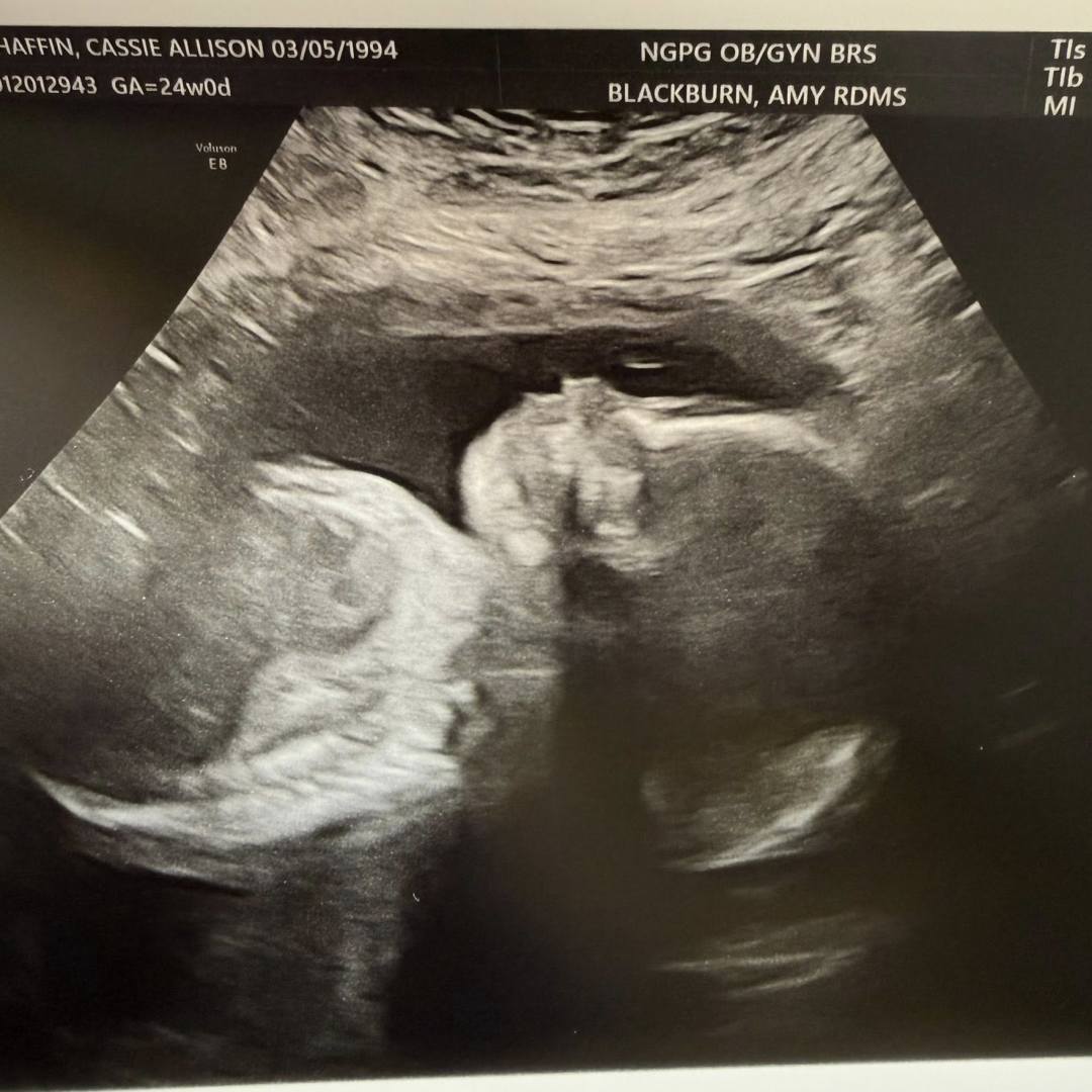 Photo shared by Cassie for their Babylist baby registry.