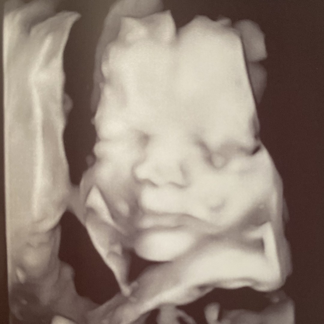 Photo shared by Lanette for their Babylist baby registry.