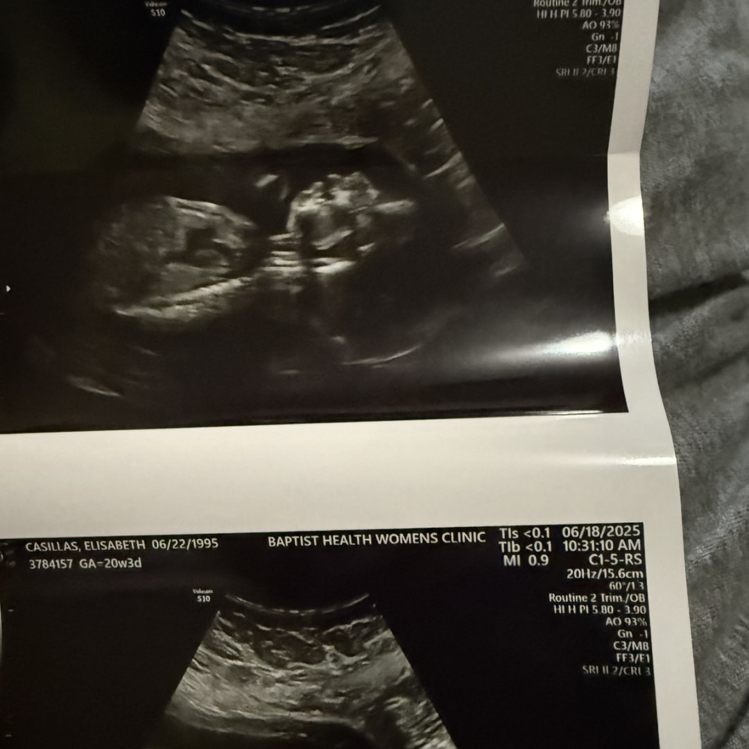Photo shared by Elisabeth for their Babylist baby registry.