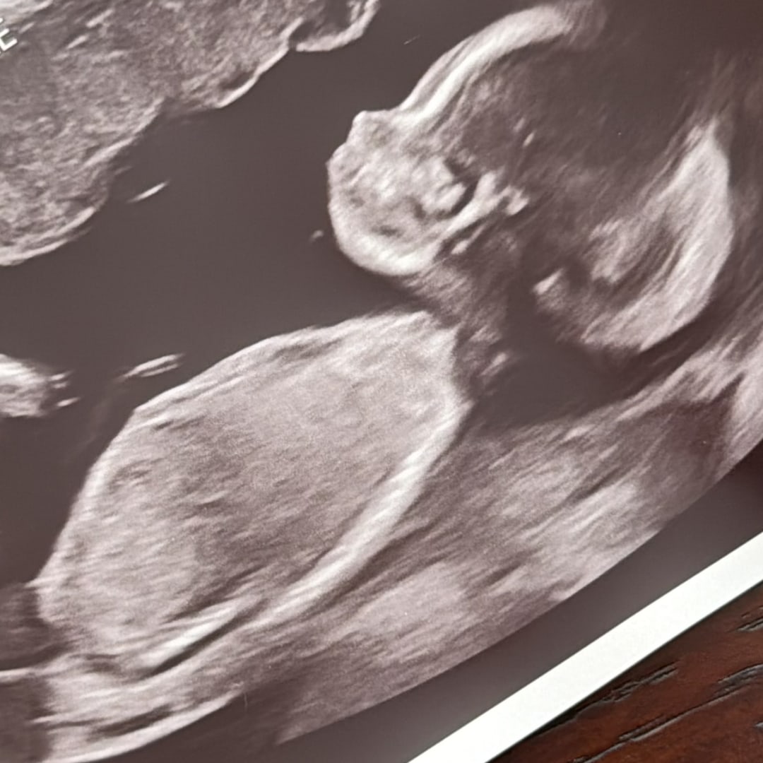 Photo shared by Ashley for their Babylist baby registry.