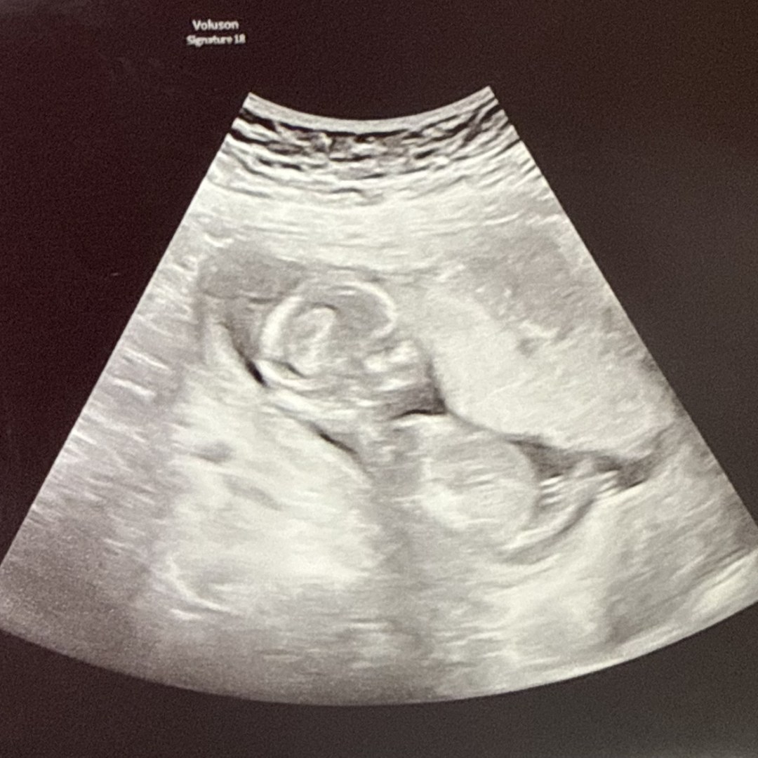 Photo shared by Michelle for their Babylist baby registry.