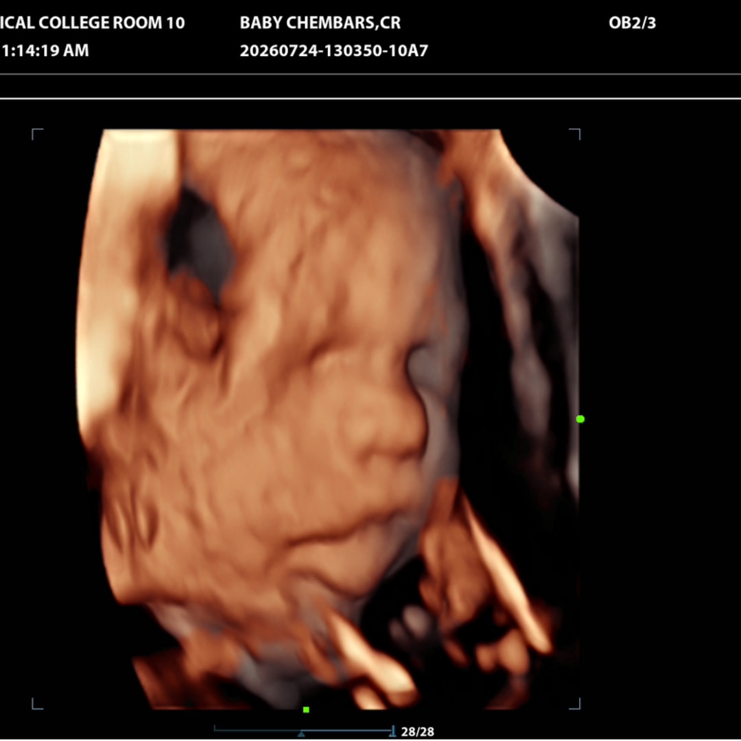 Photo shared by Christiana for their Babylist baby registry.