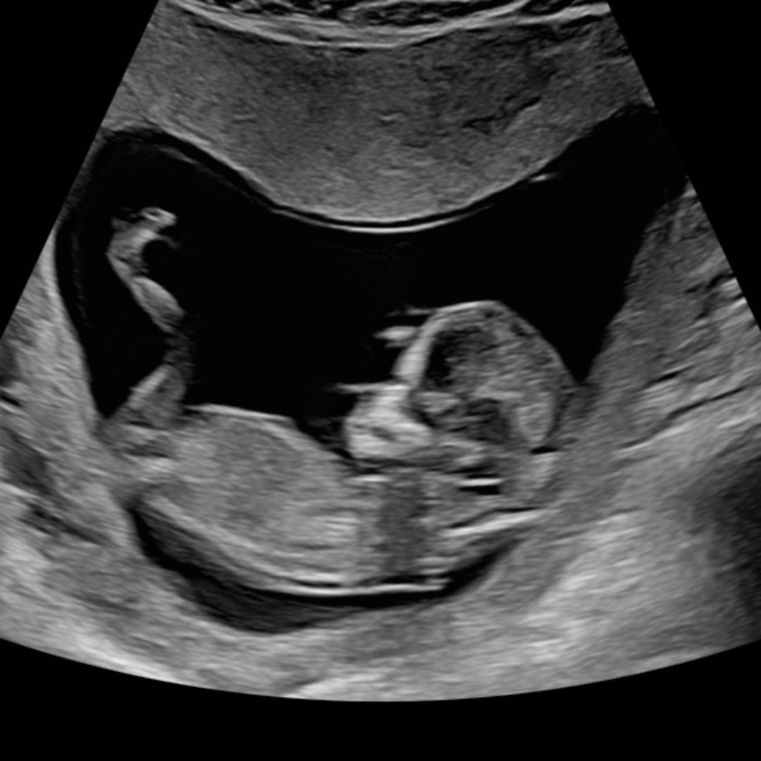 Photo shared by Sara for their Babylist baby registry.