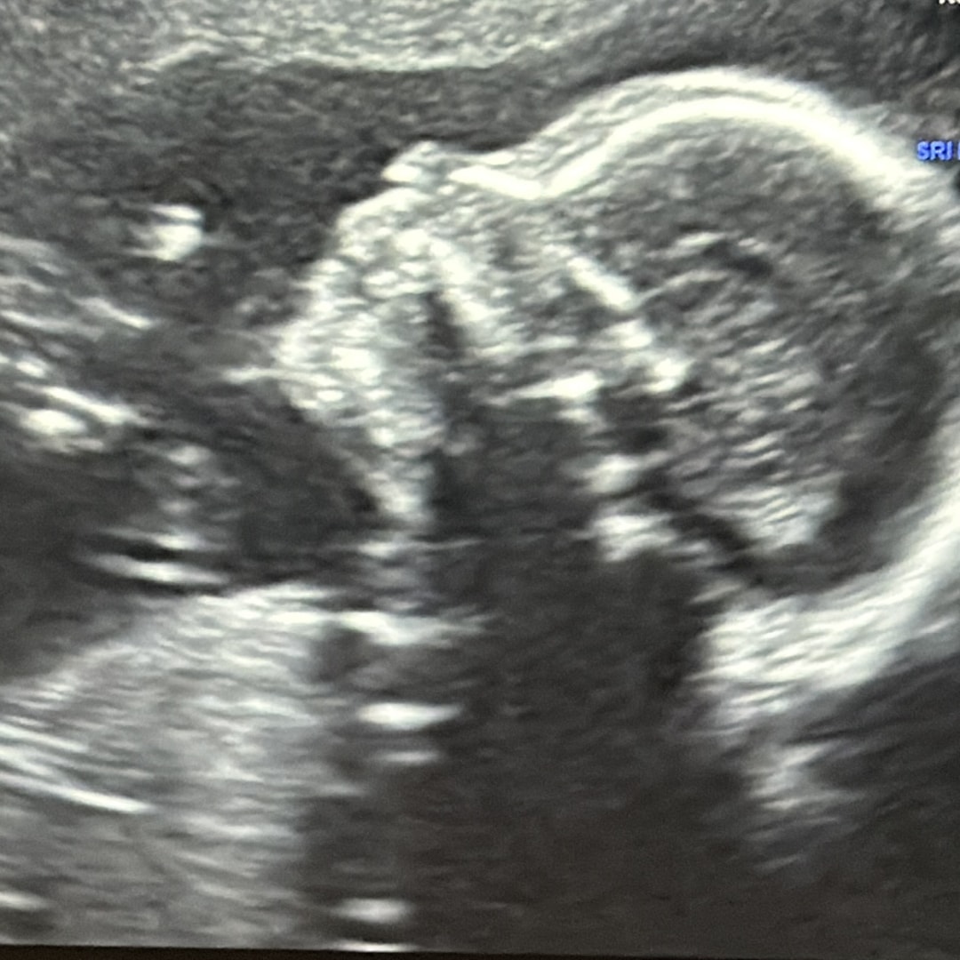 Photo shared by Hannah for their Babylist baby registry.