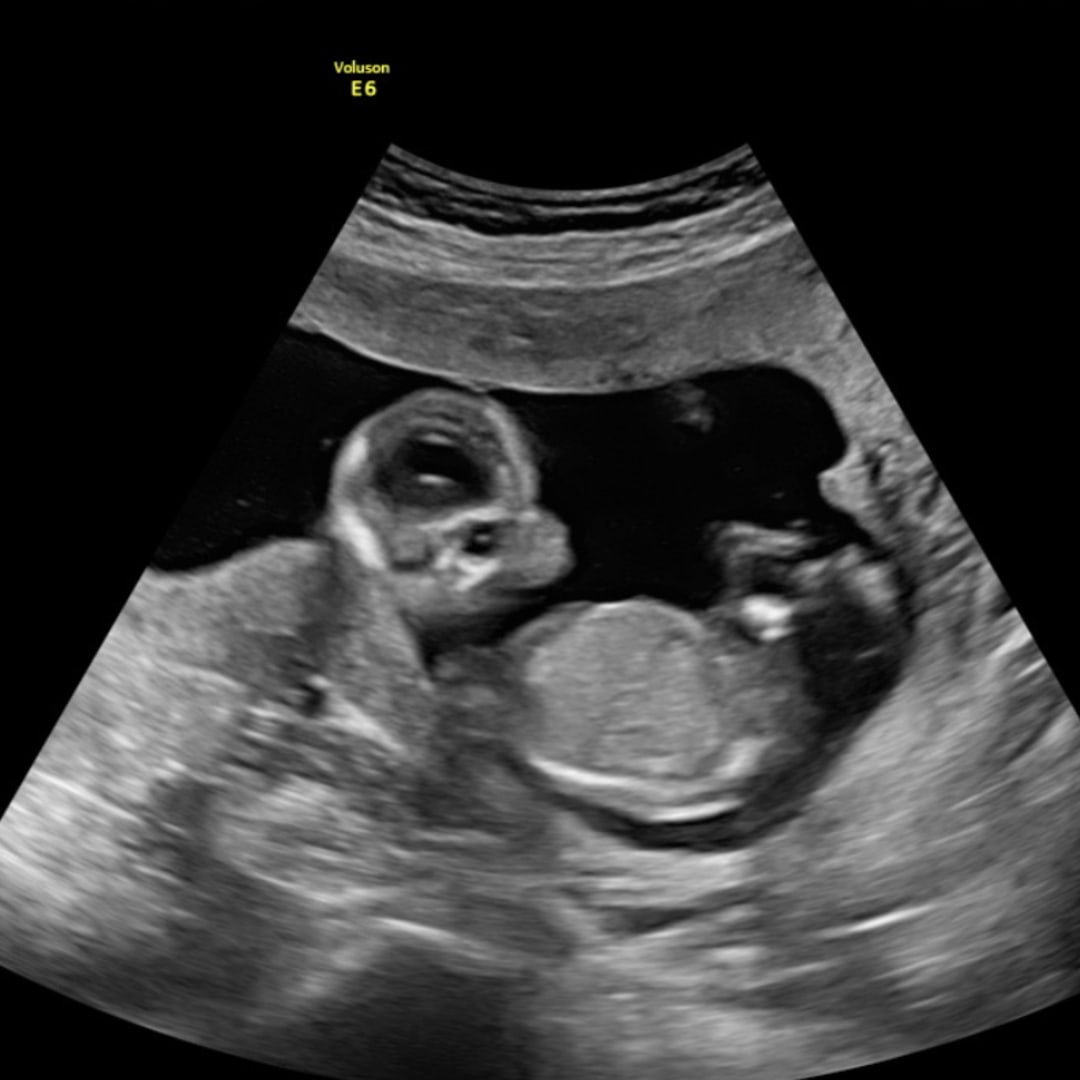 Photo shared by Madison for their Babylist baby registry.