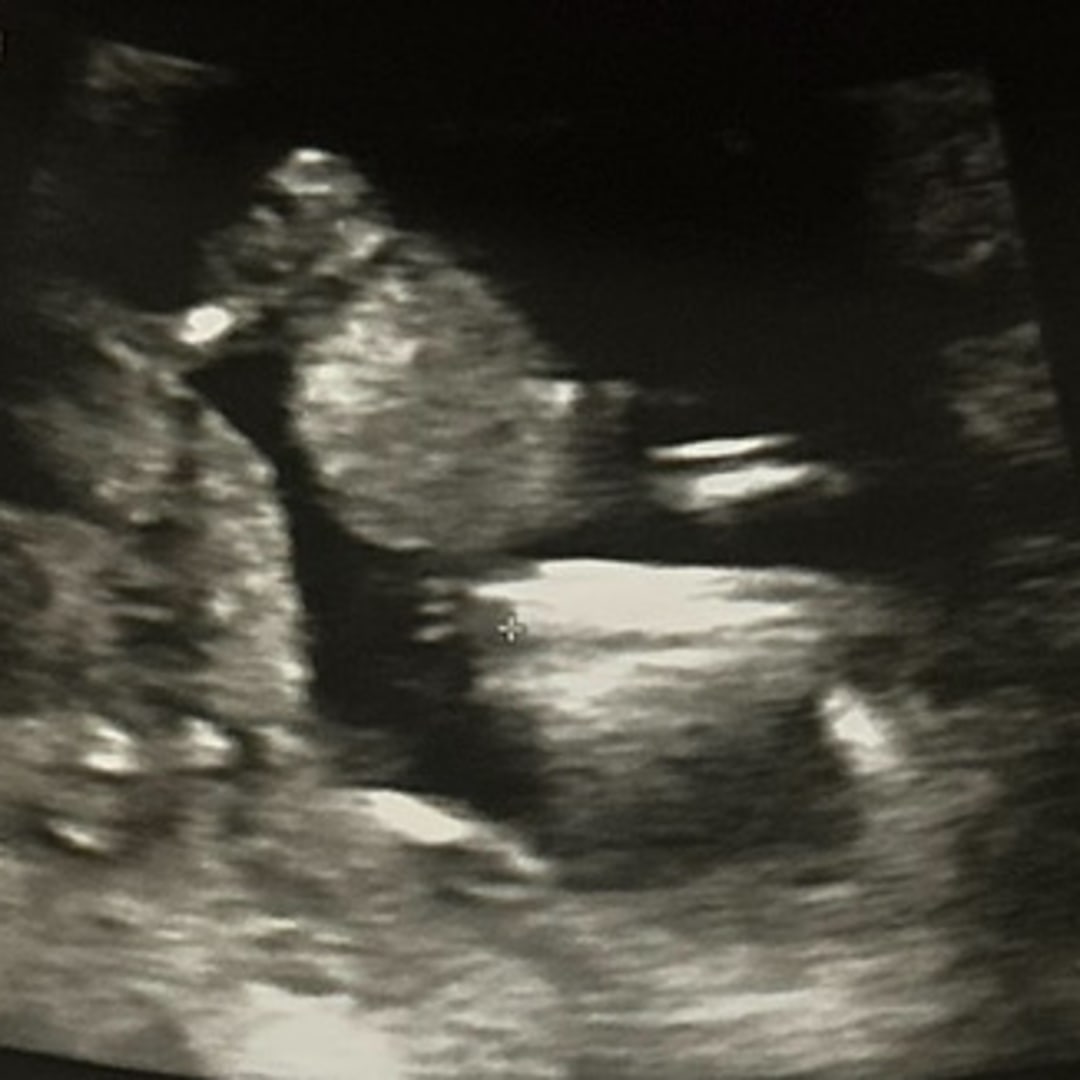 Photo shared by Chella for their Babylist baby registry.