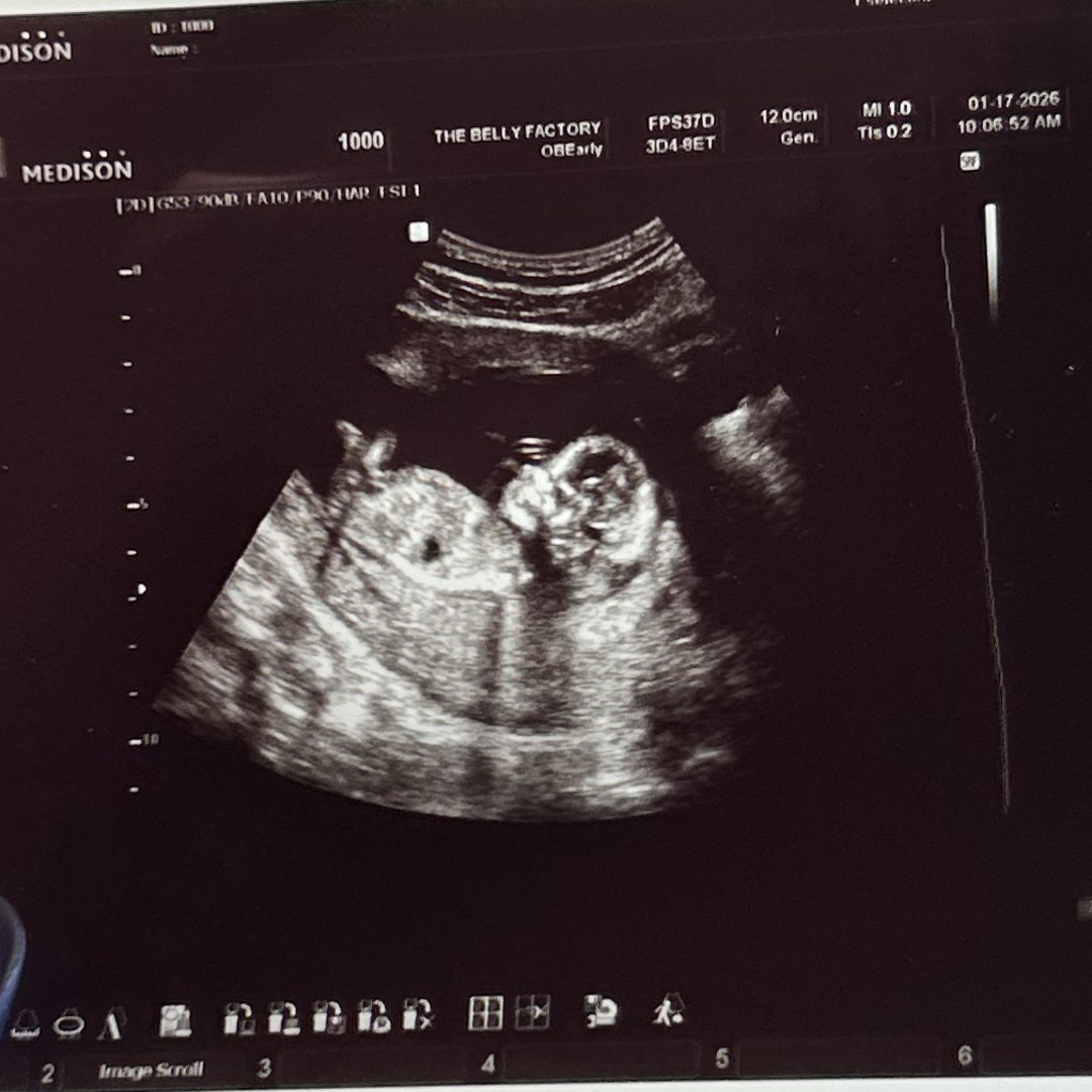 Photo shared by Jessie for their Babylist baby registry.