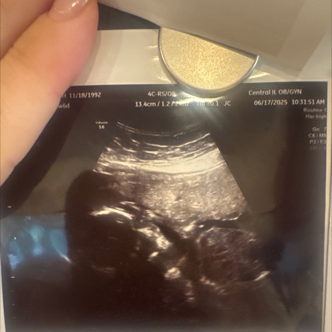 Photo shared by Hannah for their Babylist baby registry.