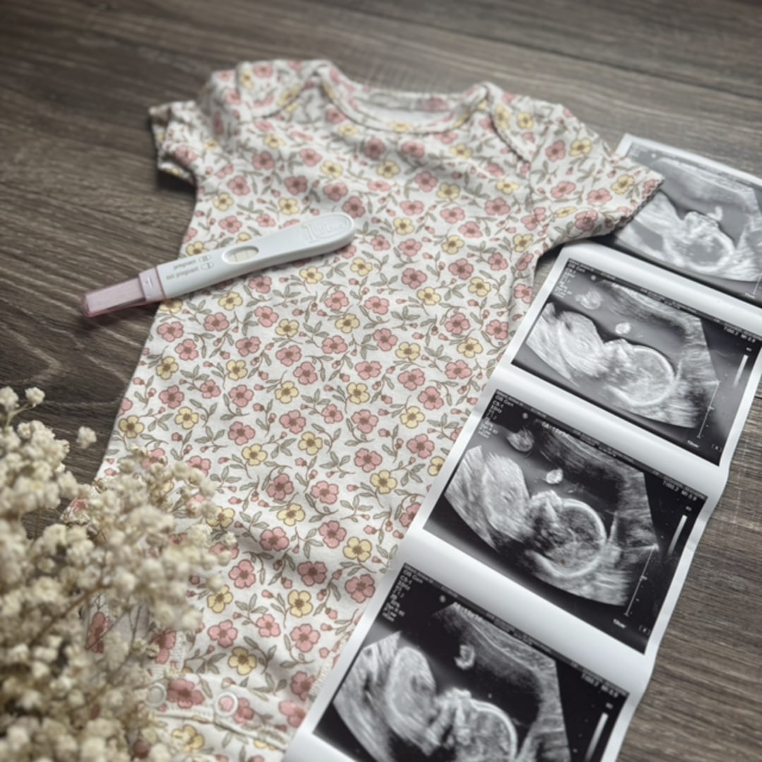 Photo shared by Amber for their Babylist baby registry.