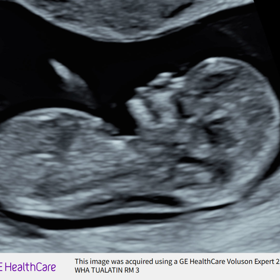 Photo shared by Hannah for their Babylist baby registry.