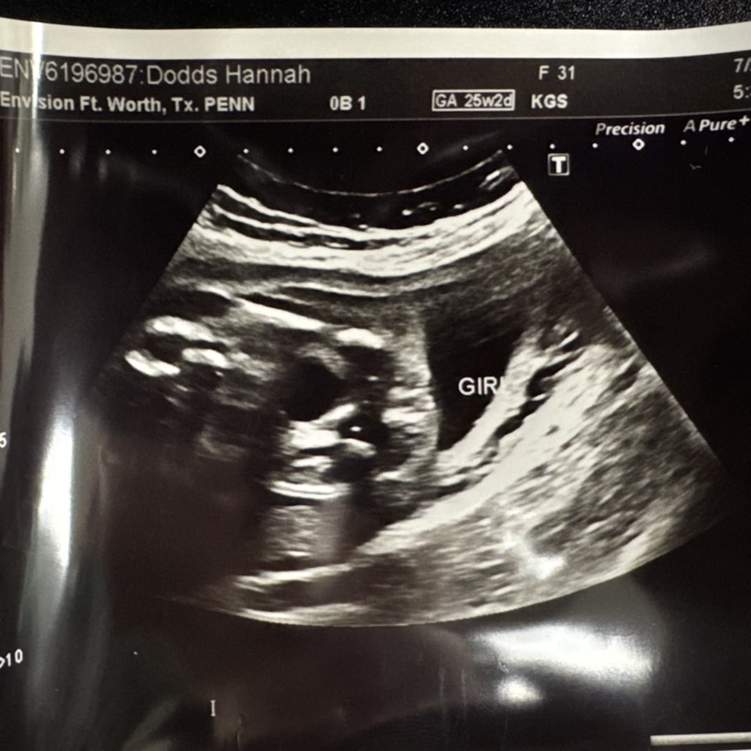 Photo shared by Hannah for their Babylist baby registry.
