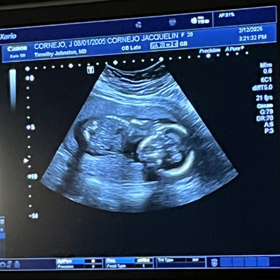 Photo shared by Jacqueline for their Babylist baby registry.