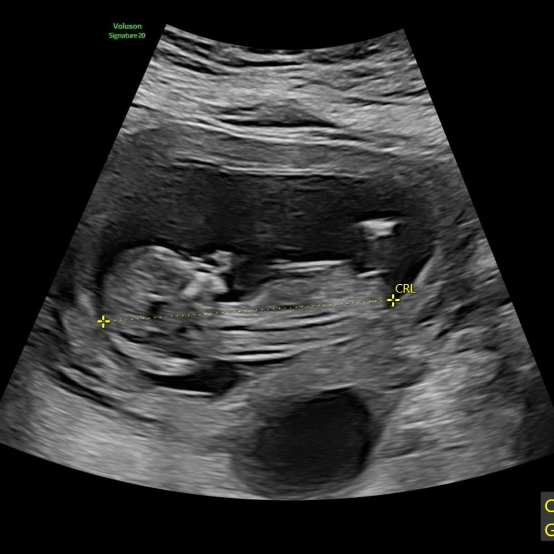 Photo shared by Katie for their Babylist baby registry.