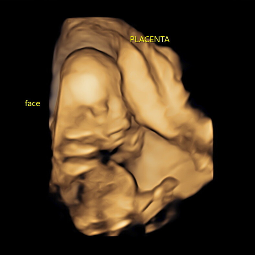 Photo shared by Nercy for their Babylist baby registry.