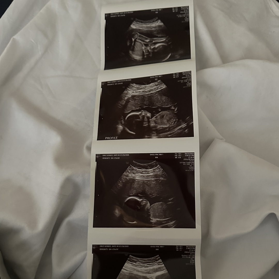 Photo shared by Kate for their Babylist baby registry.