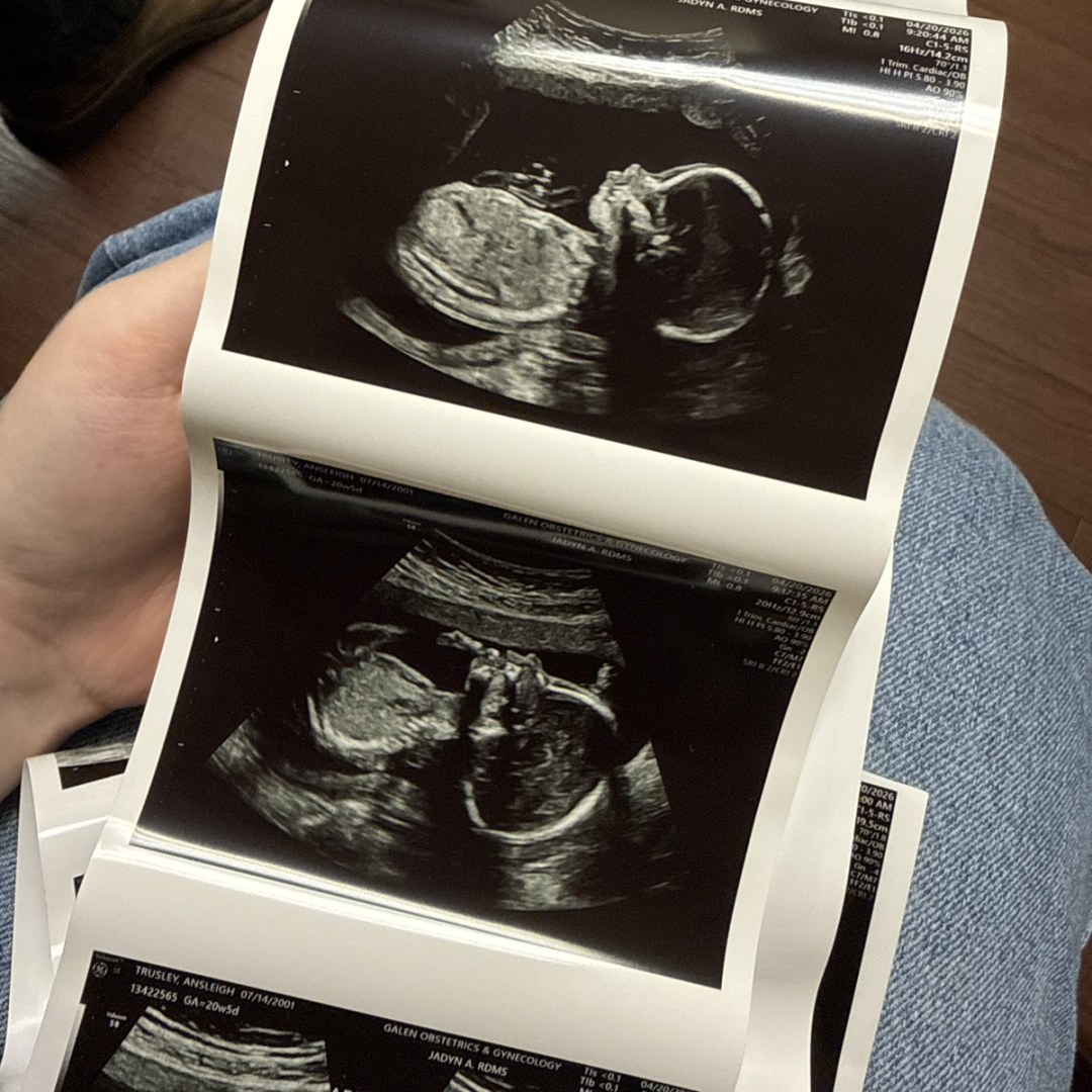 Photo shared by Ansleigh for their Babylist baby registry.