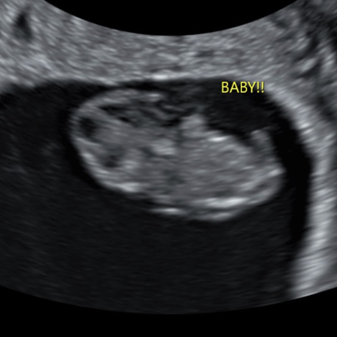 Photo shared by Francesca for their Babylist baby registry.