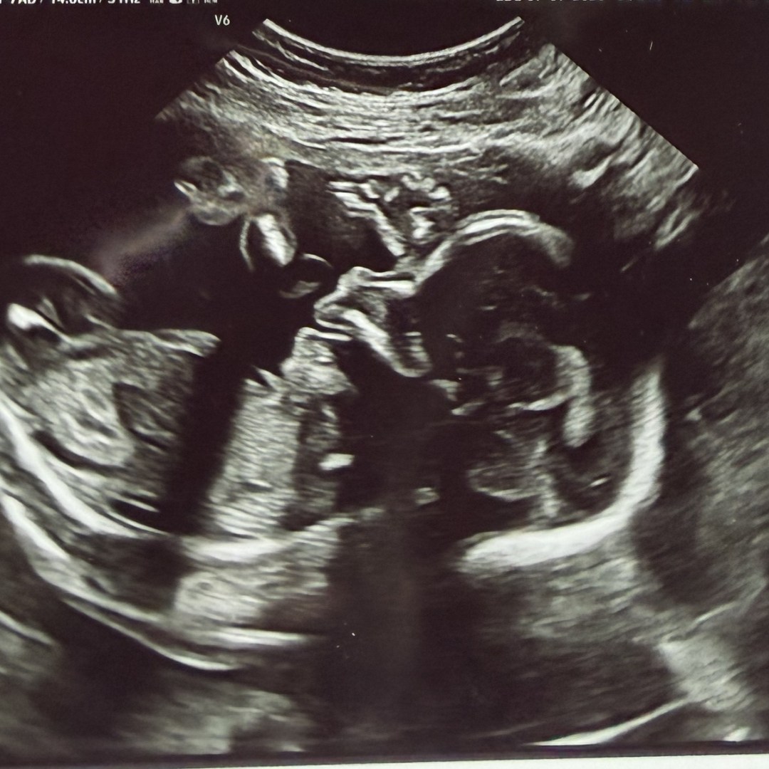 Photo shared by Logan for their Babylist baby registry.