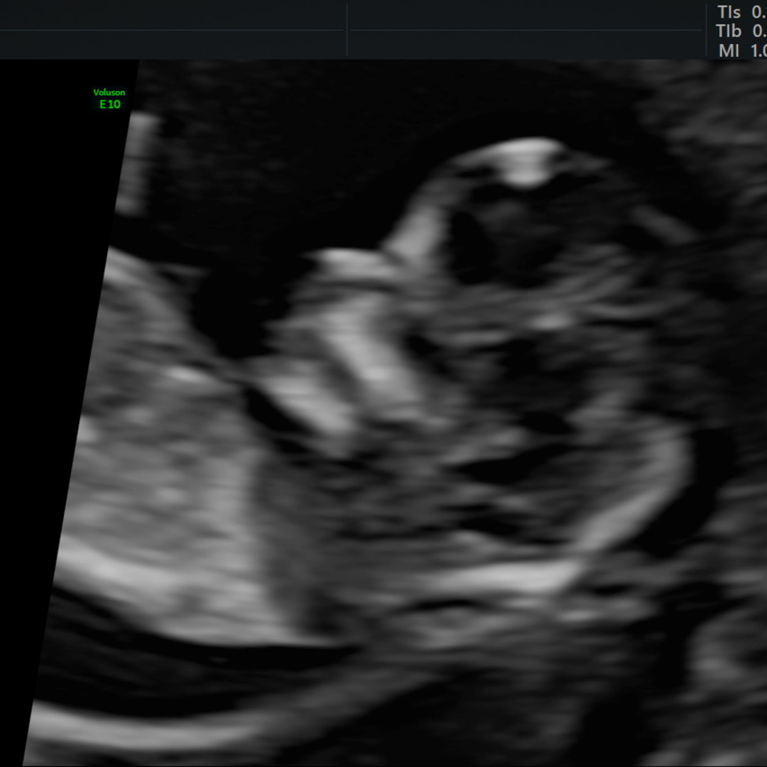 Photo shared by Pegah and Matthew for their Babylist baby registry.