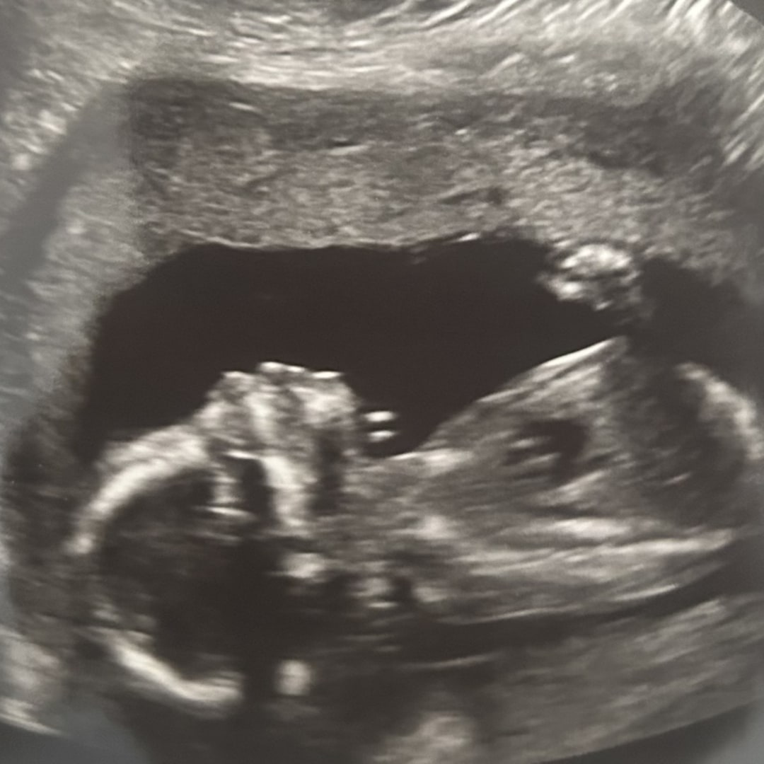 Photo shared by Ashley for their Babylist baby registry.