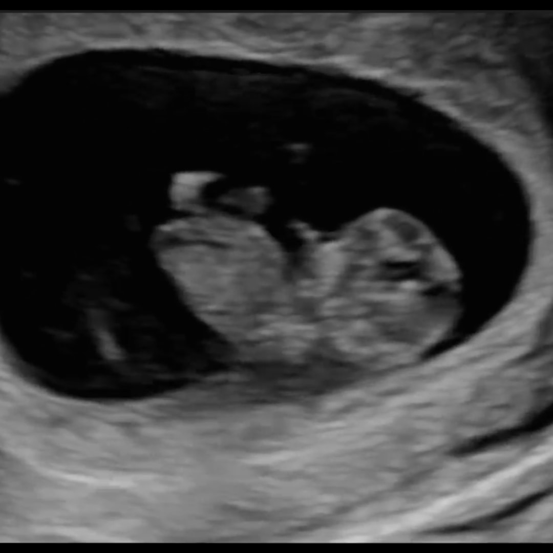 Photo shared by Caroline for their Babylist baby registry.