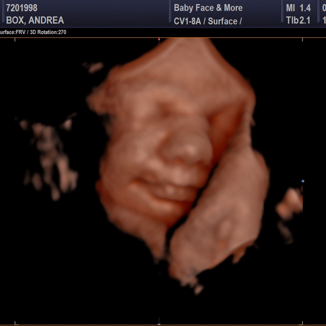Photo shared by Andrea for their Babylist baby registry.