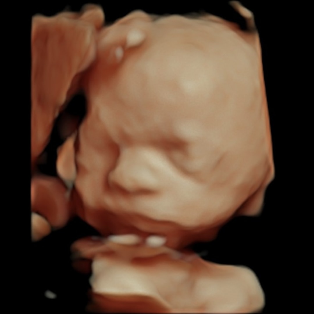 Photo shared by Shelby for their Babylist baby registry.