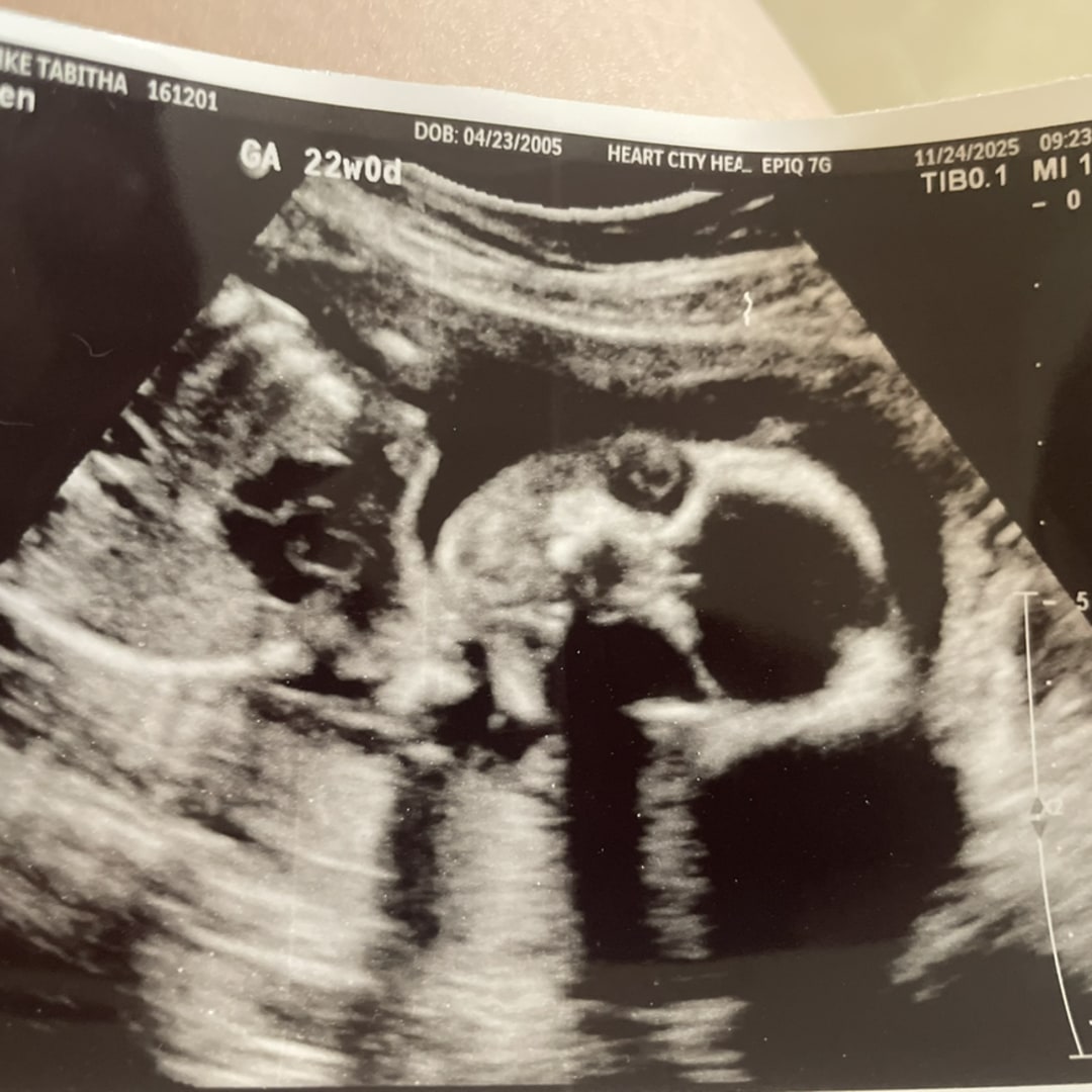 Photo shared by Tabitha for their Babylist baby registry.