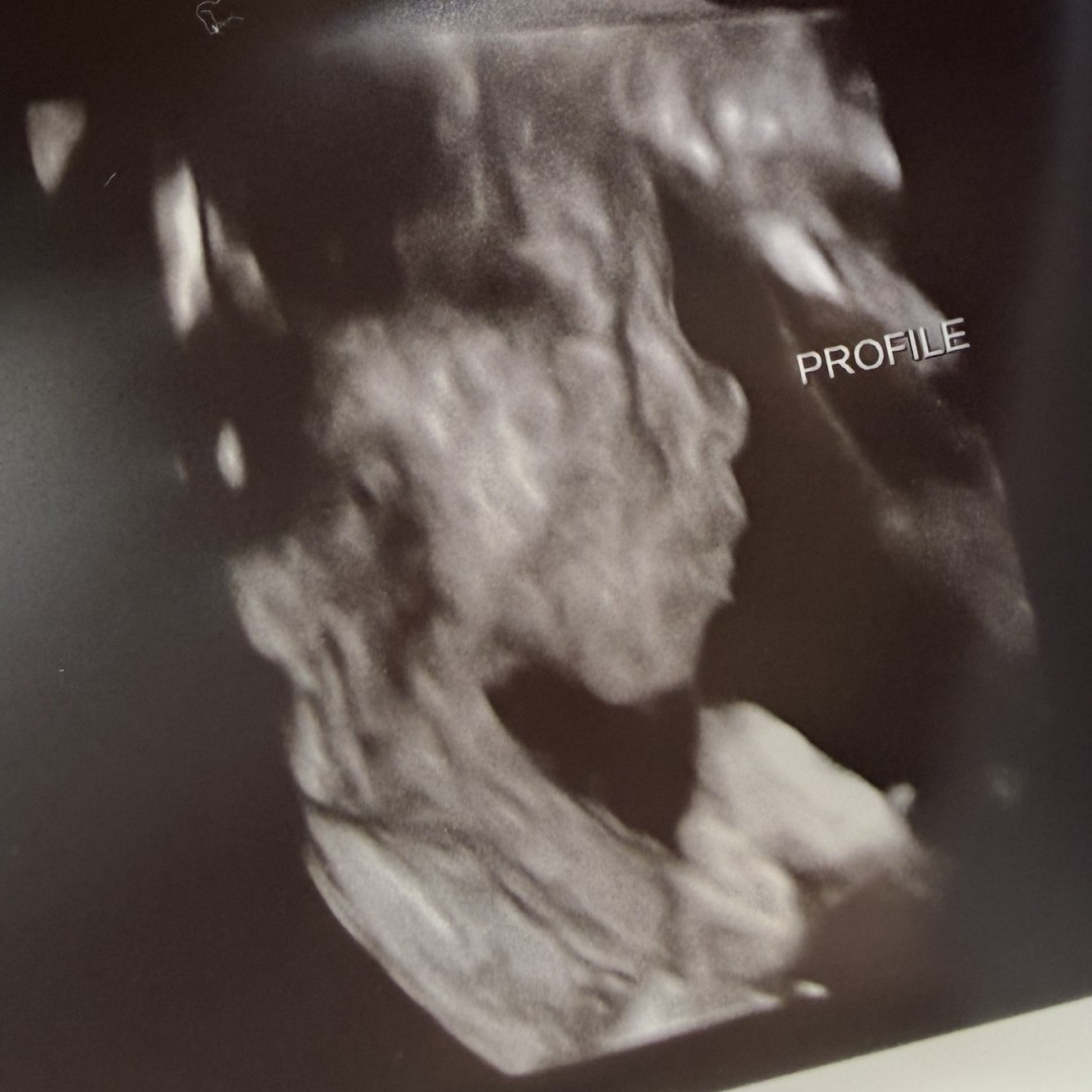 Photo shared by Amber for their Babylist baby registry.