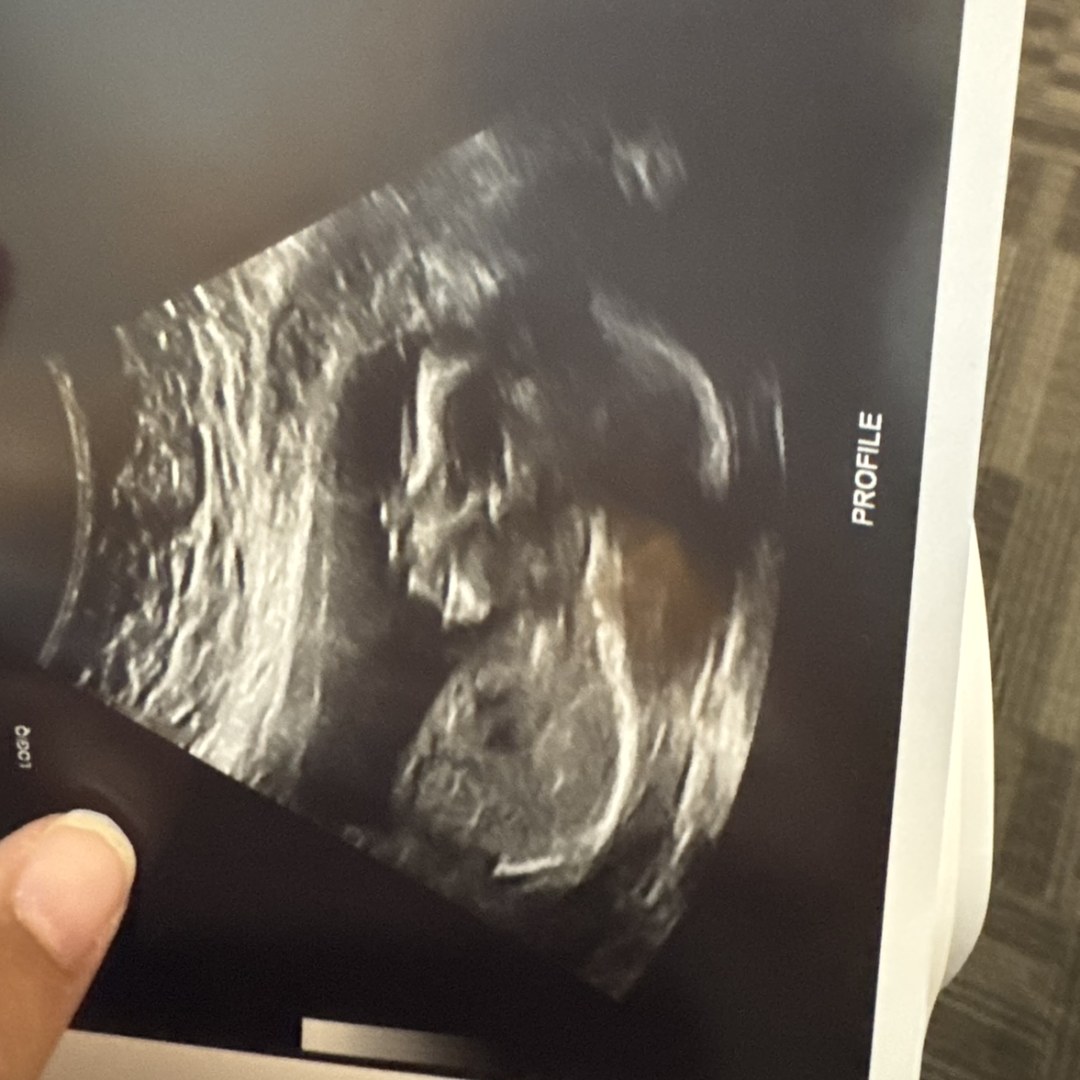 Photo shared by Janie for their Babylist baby registry.
