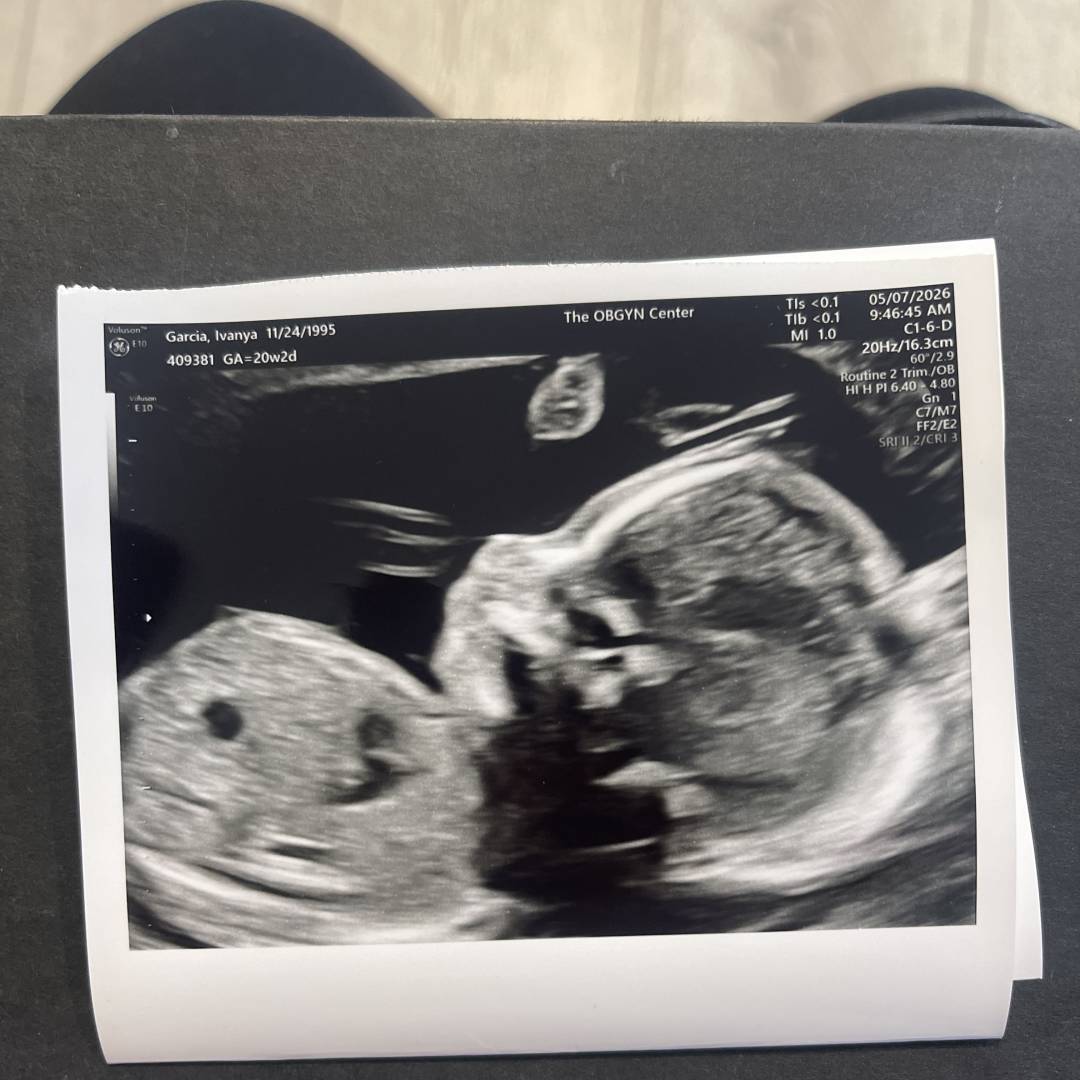 Photo shared by Ivanya for their Babylist baby registry.