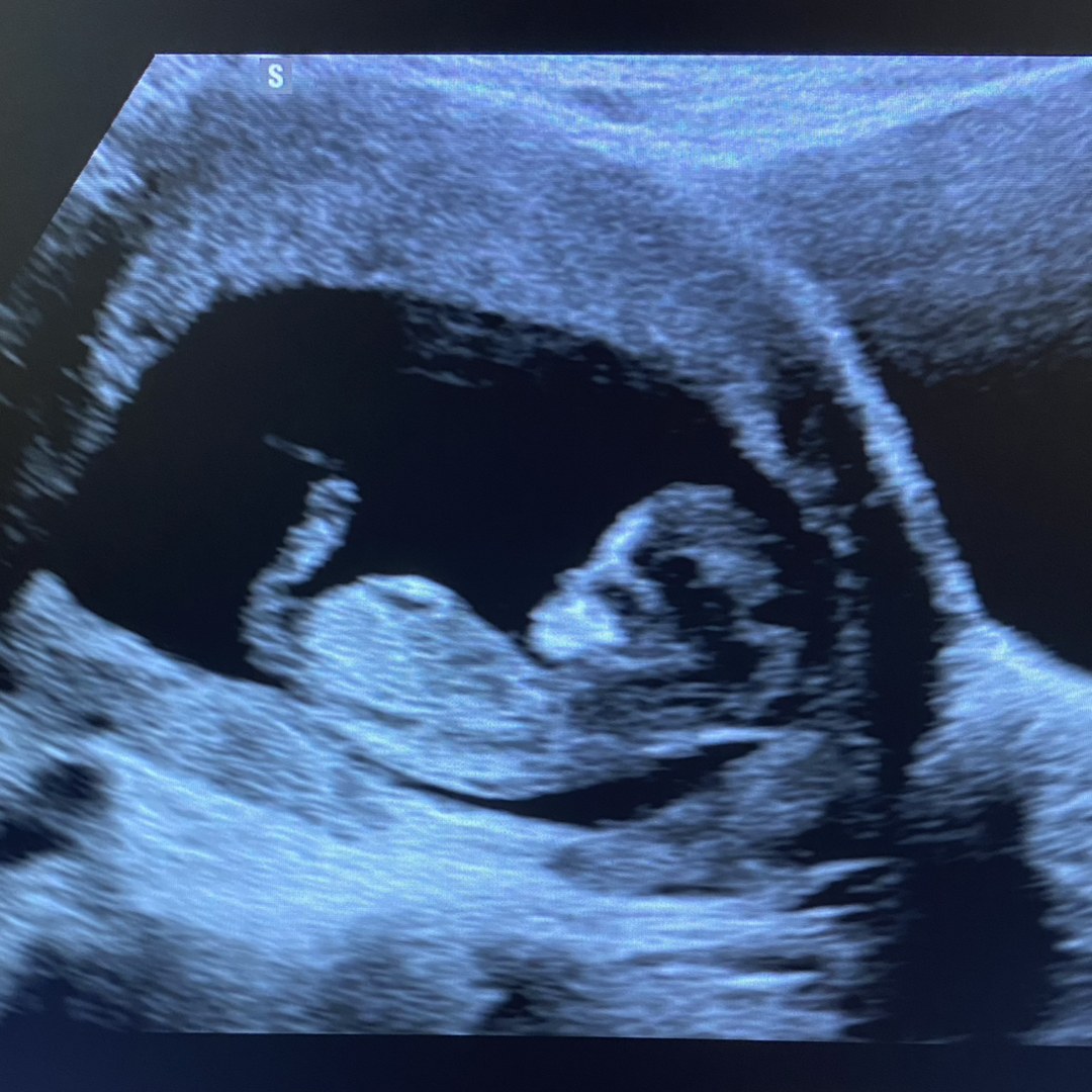 Photo shared by Jaida for their Babylist baby registry.