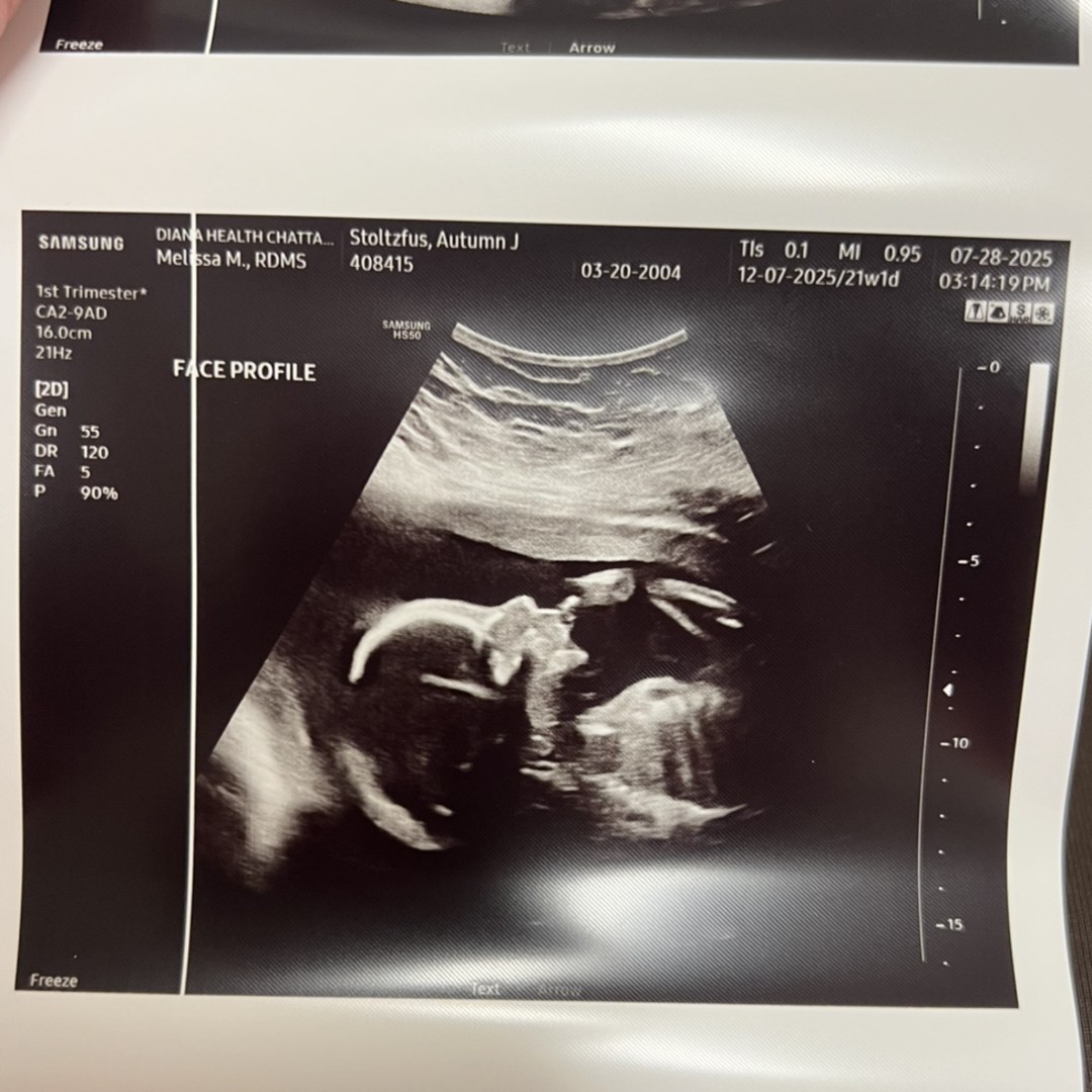 Photo shared by Autumn for their Babylist baby registry.