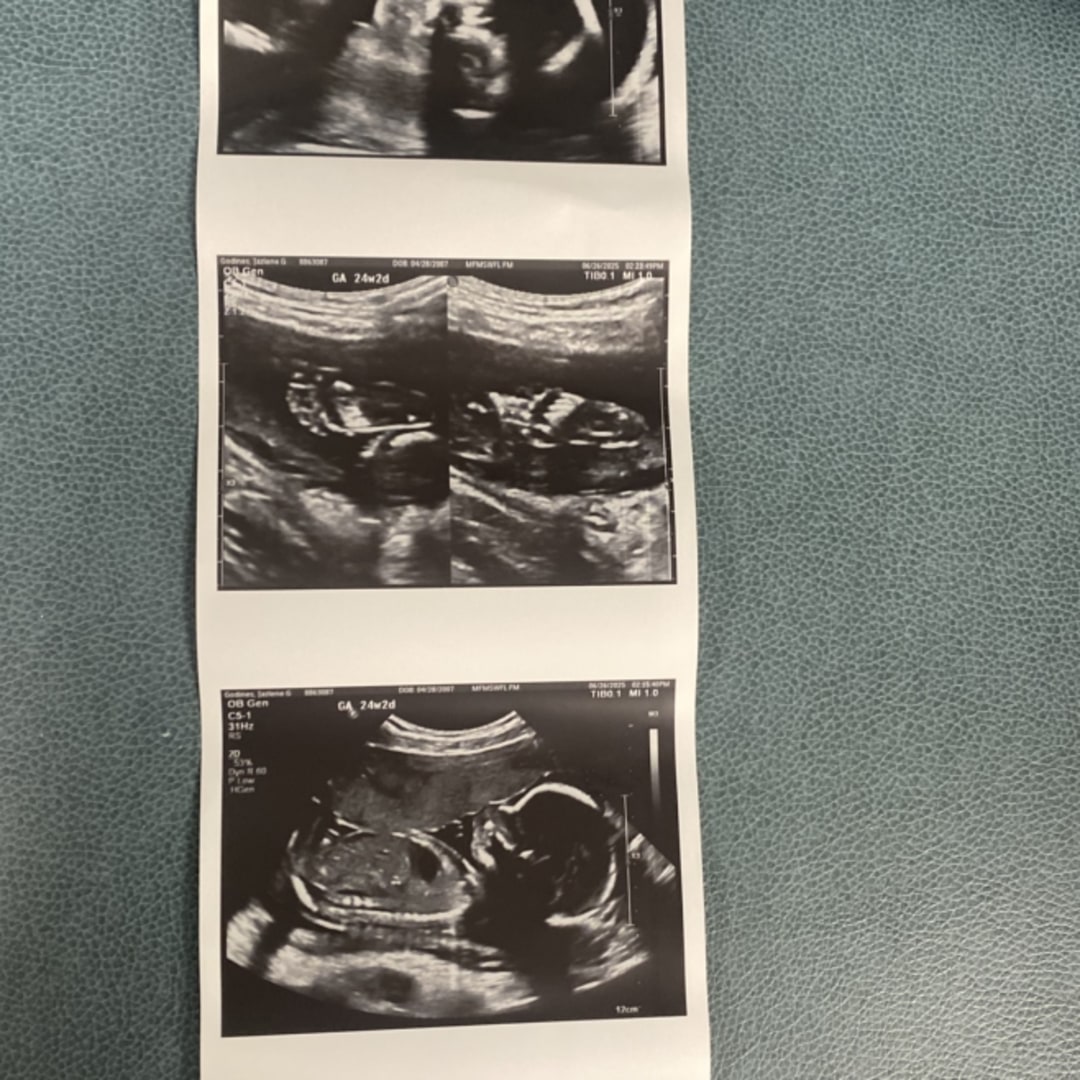 Photo shared by Jazlene for their Babylist baby registry.