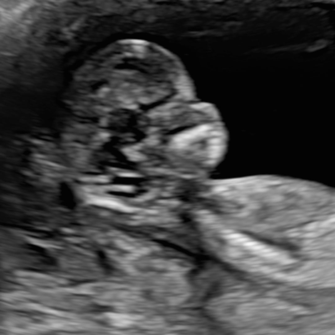 Photo shared by Stella for their Babylist baby registry.