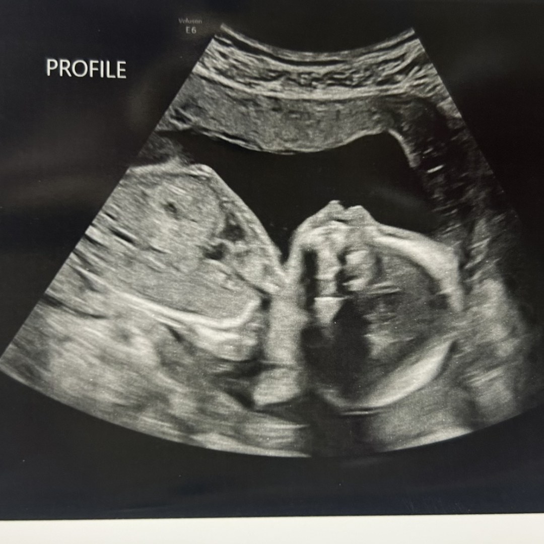 Photo shared by Audrey for their Babylist baby registry.