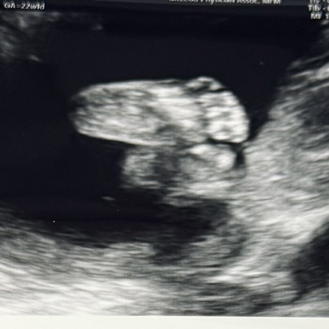 Photo shared by Crystal for their Babylist baby registry.