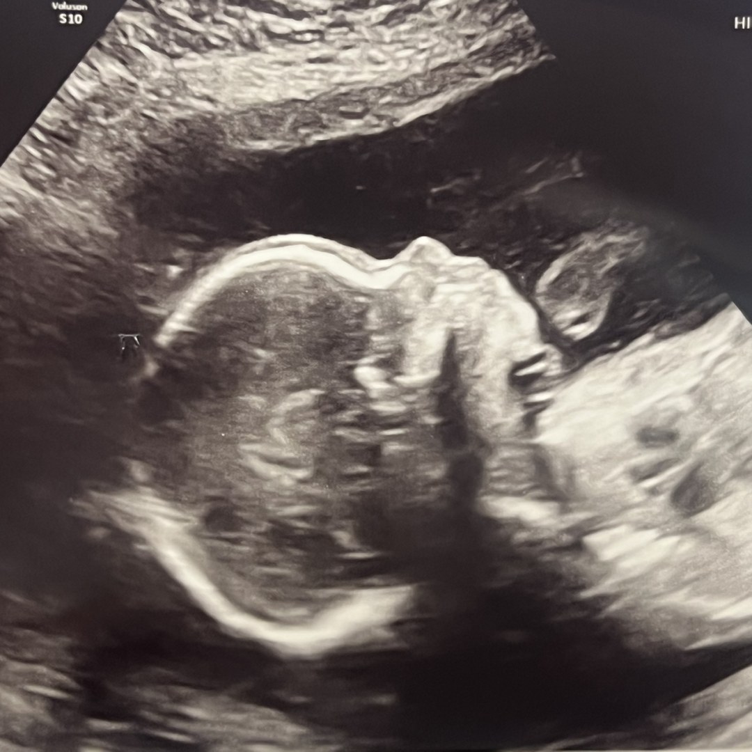 Photo shared by Cassidy for their Babylist baby registry.