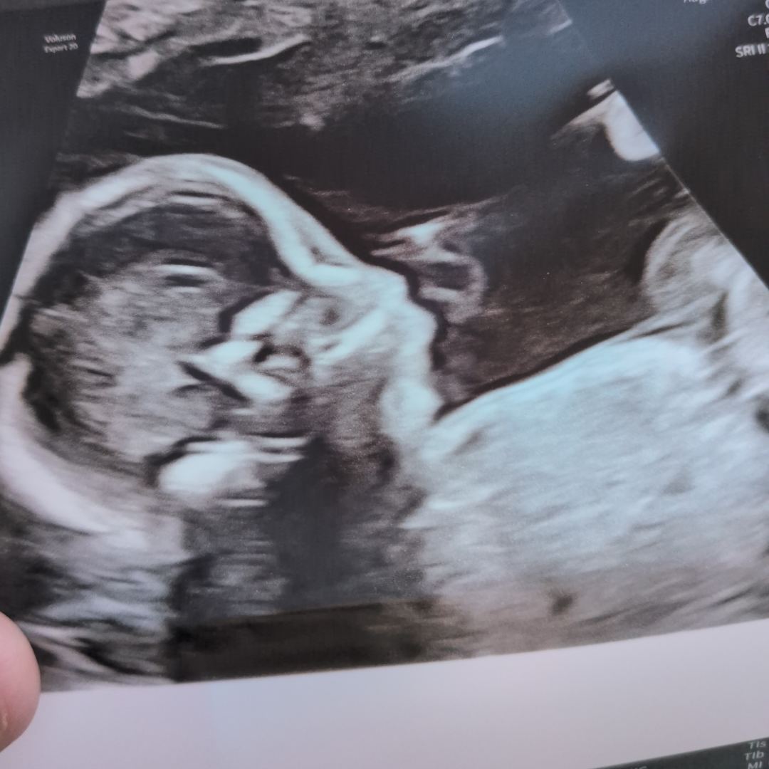 Photo shared by Emily for their Babylist baby registry.