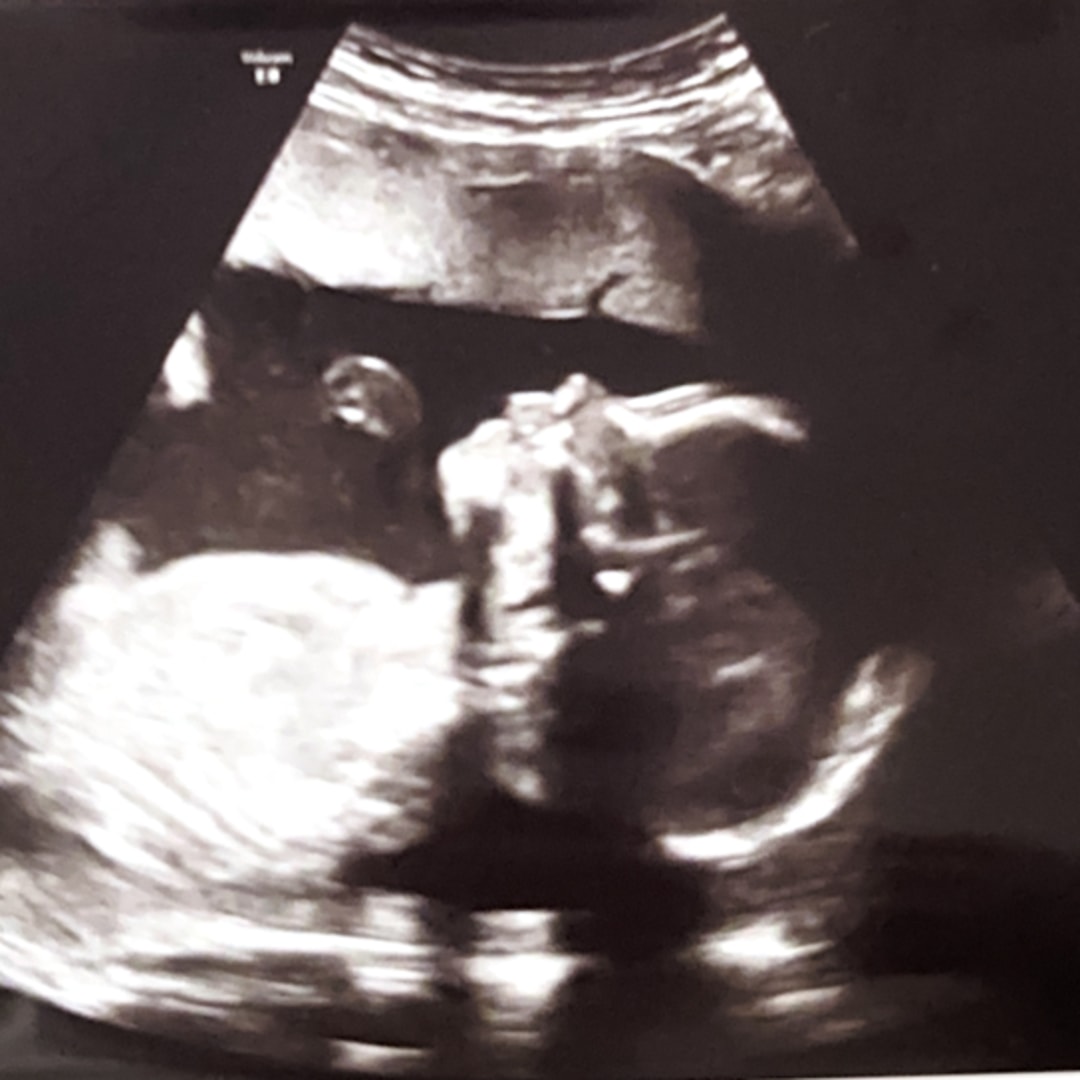 Photo shared by Savannah for their Babylist baby registry.