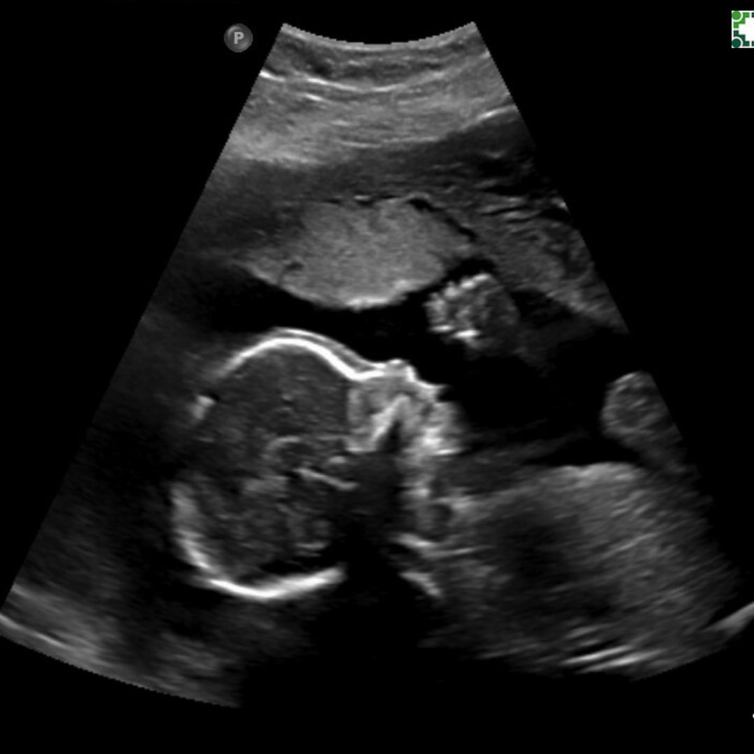 Photo shared by Will for their Babylist baby registry.