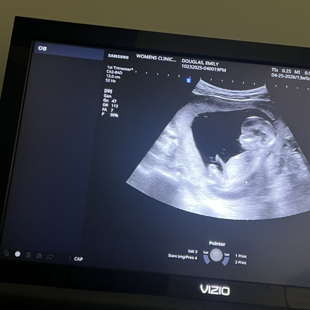 Photo shared by Emily for their Babylist baby registry.