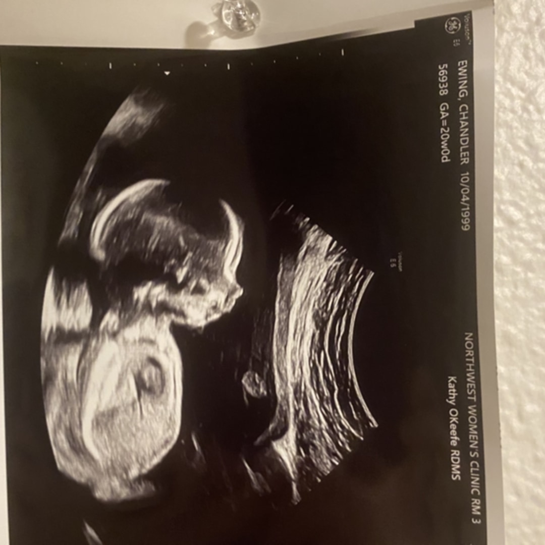 Photo shared by Chandler for their Babylist baby registry.