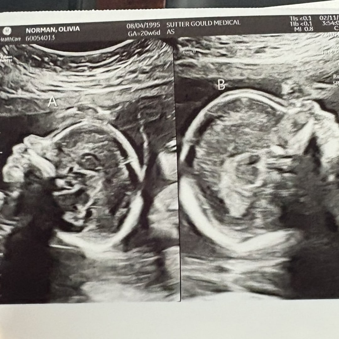 Photo shared by Will and Olivia for their Babylist baby registry.