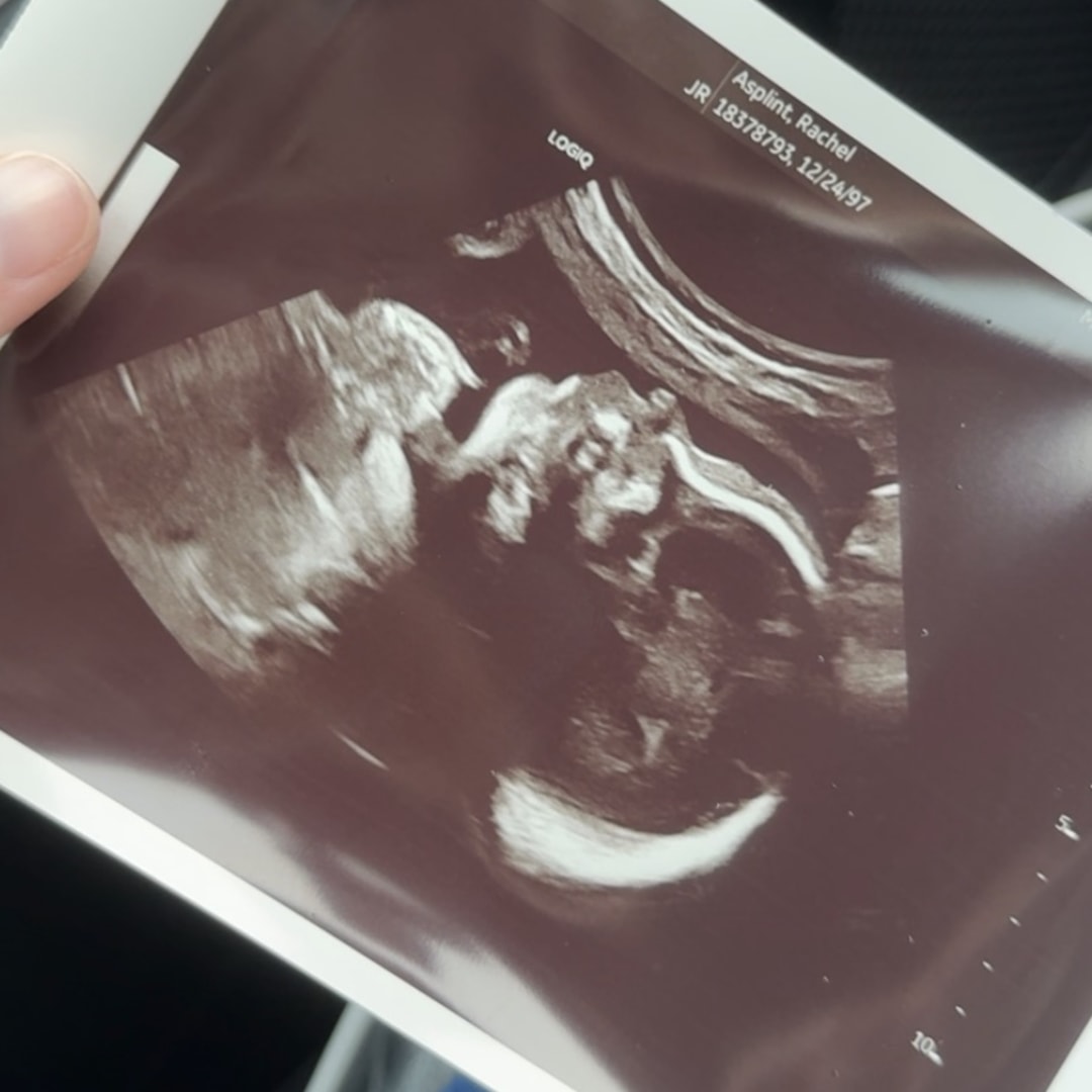 Photo shared by Rachel for their Babylist baby registry.