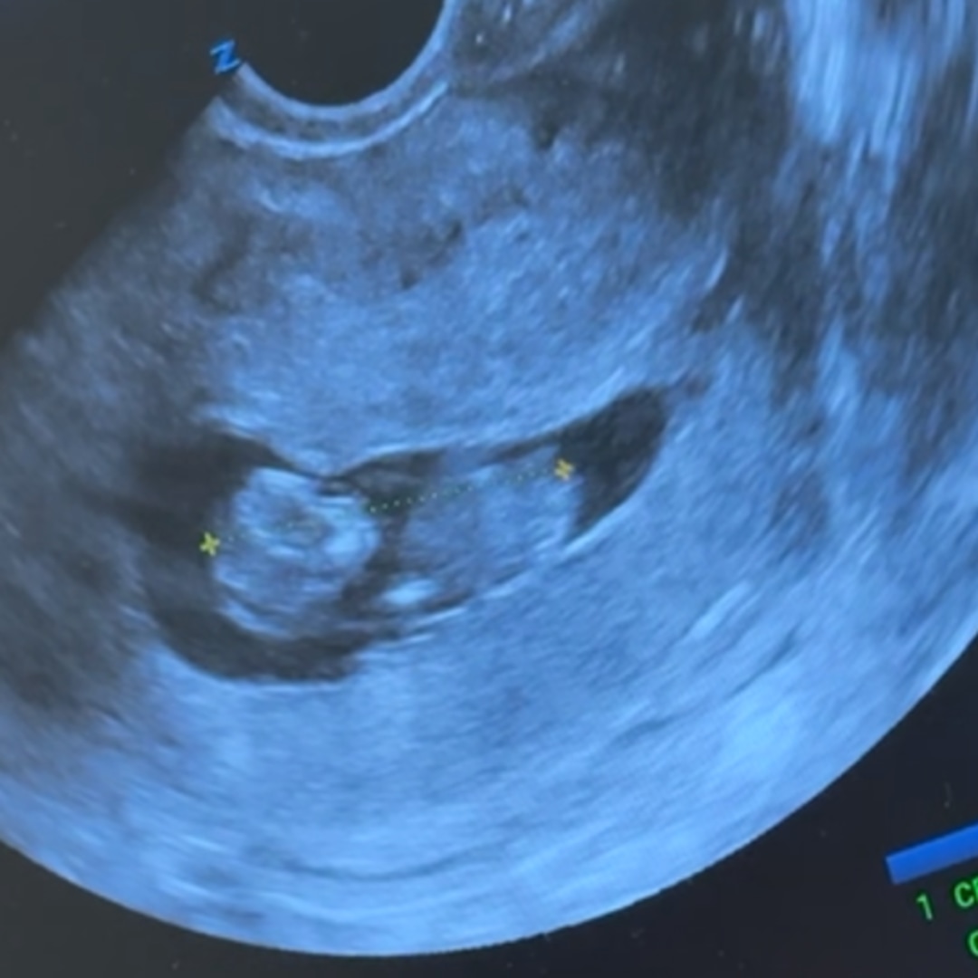 Photo shared by Patricia for their Babylist baby registry.