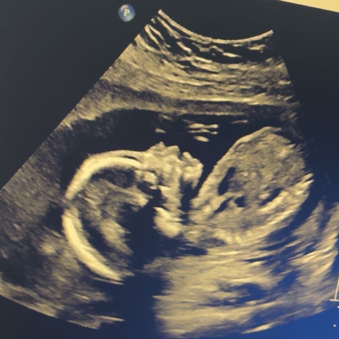 Photo shared by Caroline for their Babylist baby registry.